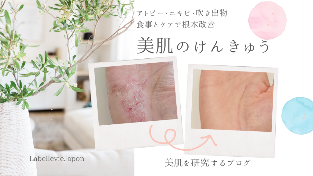 アトピー改善